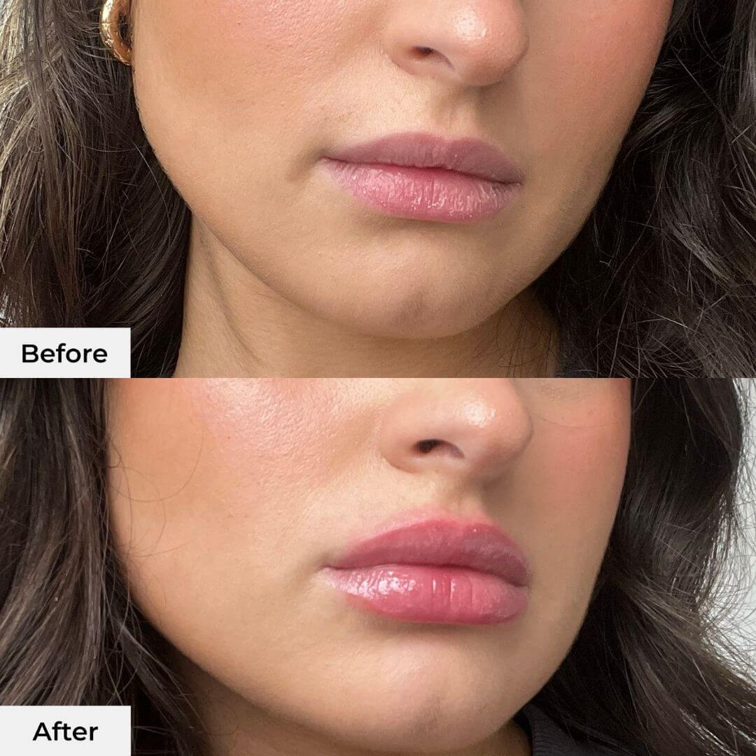 Instant Lip Plumper